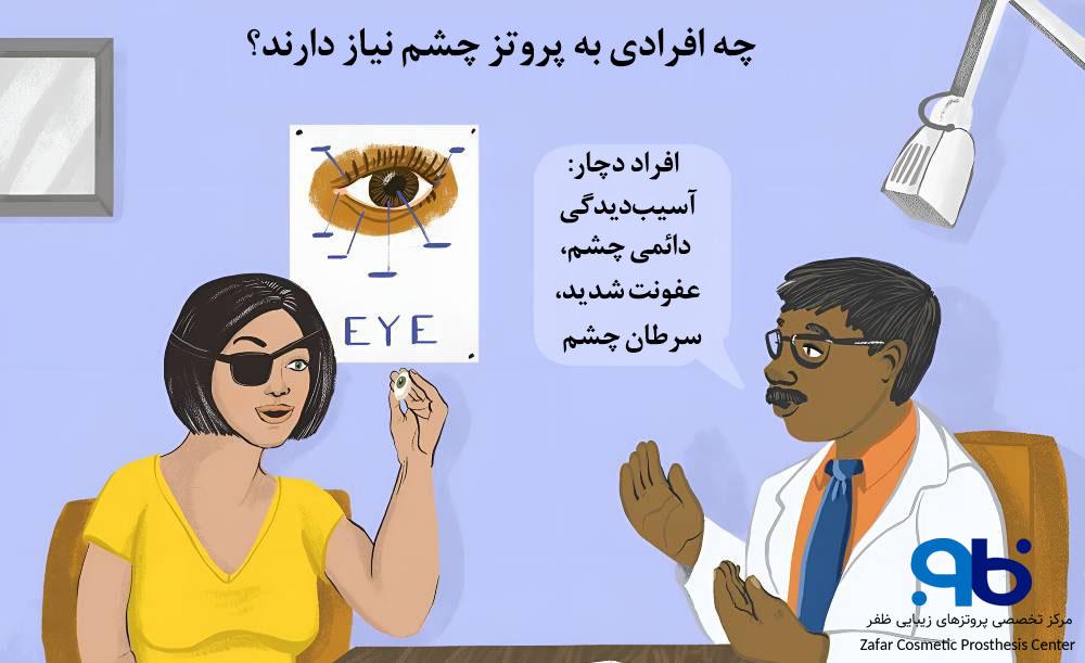 چه کسانی نیاز به استفاده از پروتز چشم دارند؟