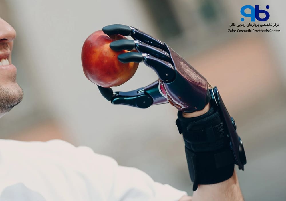 حرکت پروتزهای میوالکتریک با استفاده از موتور