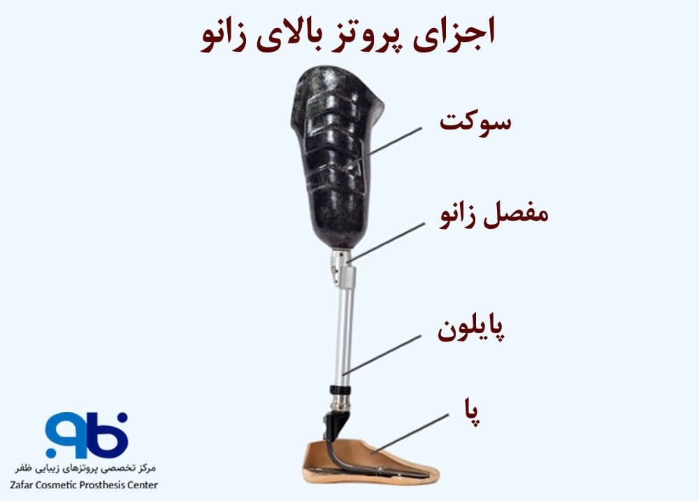 عوامل مهم برای تعیین نوع پروتز