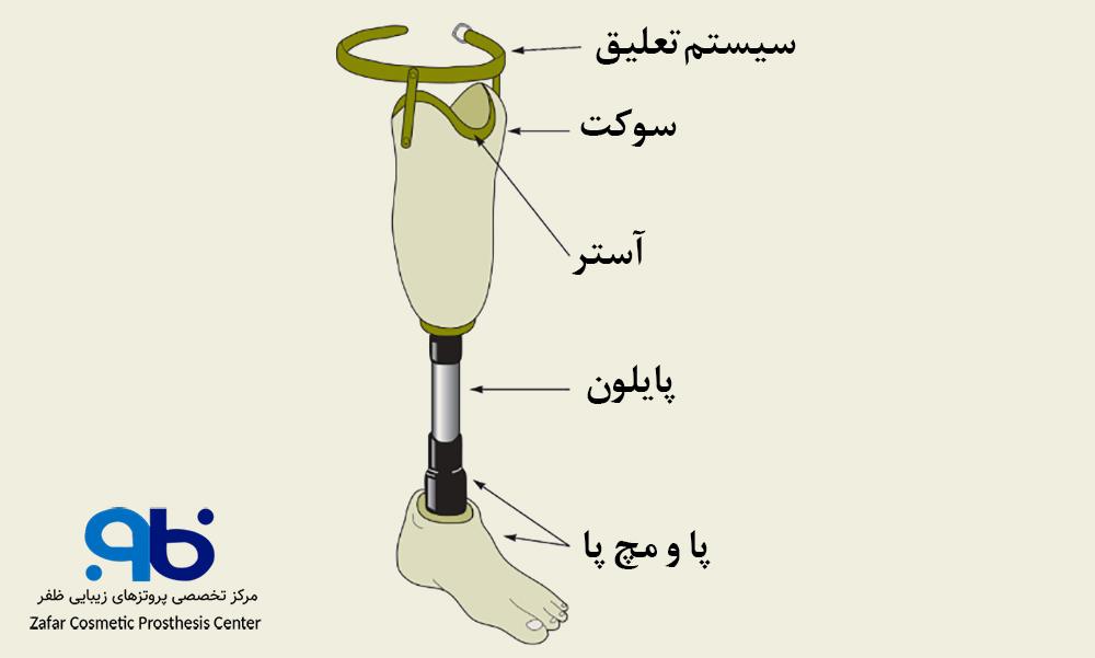 اجزای تشکیلدهنده پروتز زیر زانو