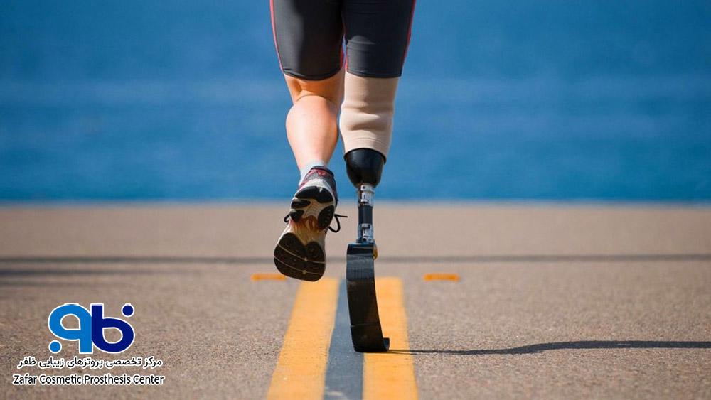 پنجه ورزشی پا (Sport Foot)