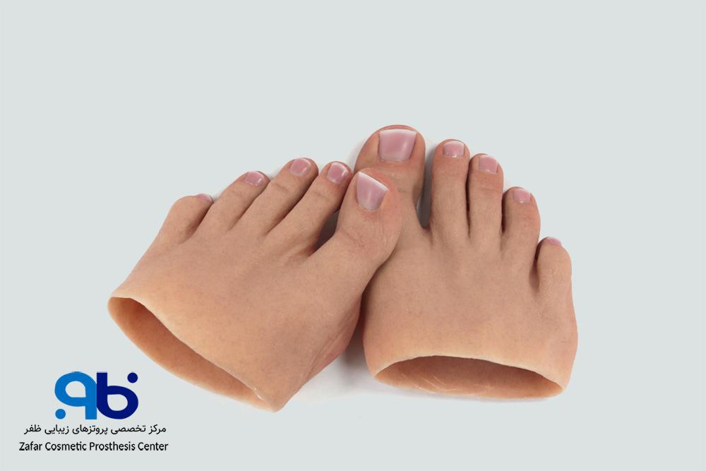 پروتز جزئی پا