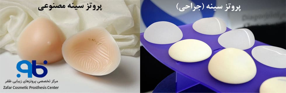 پروتز سینه و پروتز سینه مصنوعی