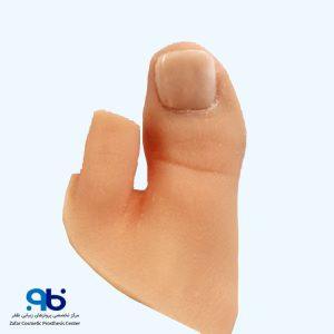 ساخت پروتزمصنوعی بخشی از پا در کلینیک ظفر