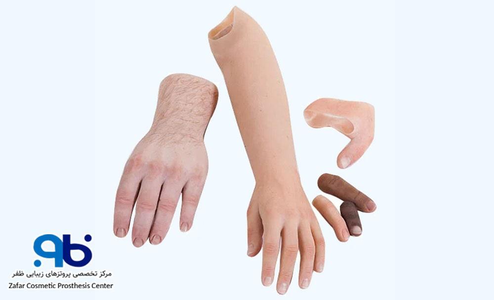 انواع پروتز دست مصنوعی