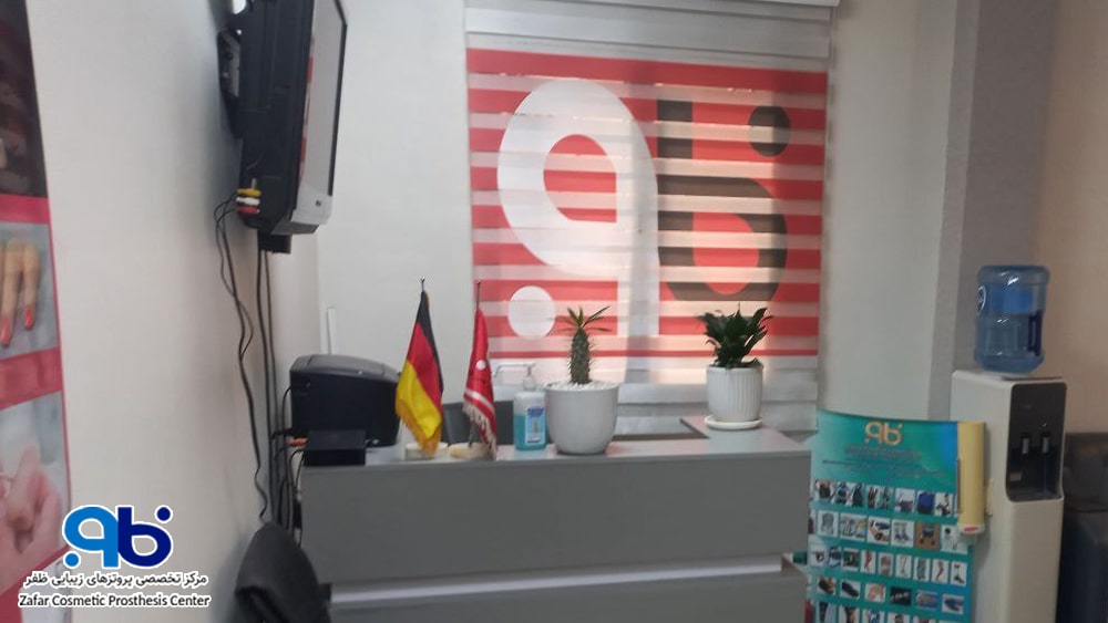تهیه پروتز