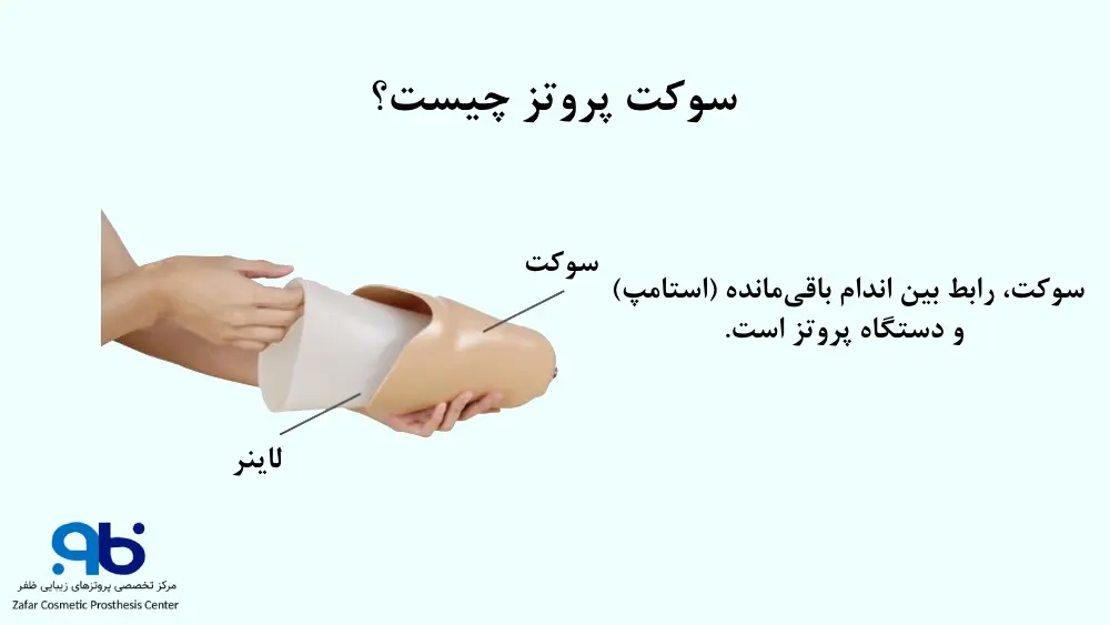 نقش سوکت پروتز