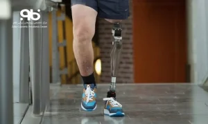 leg-prosthesis18
