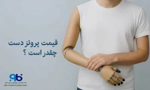 قیمت پروتز دست